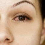 oci-crvene-iritacija-crvenilo-upala