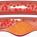sirup-uklanja-masnocu-iz-krvi