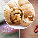 malje-po-tijelu-orasi