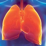 rak-pluca