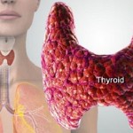 Stitna-zlezda-e1419071413129-600x3621