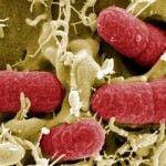 eserihija_koli_simptomi_lecenje_prenosenje