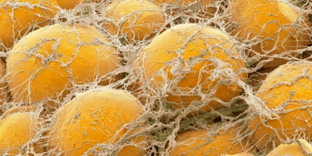 Smeđa masnoća ili dobra masnoća je jedan od najvažnijih čimbenika našeg metaboličkog sustava, ako se pravilno hranimo i ako spavamo u hladnijim prostorijama. 