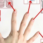 Nokti-Su-jok-terapija-f