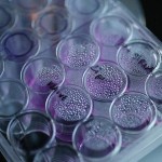 rak-celije-raka-foto-rojters