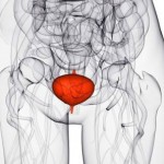 can-cranberry-juice-treat-bladder-infections