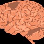 mozak-pixabay
