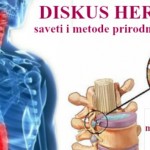 diskus-hernija