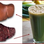 prirodno-čišćenje-masne-jetre