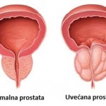 prostata