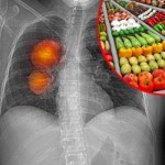 Rak-pluca-zdrava-hrana-voce-povrce-620x350