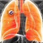 ocistite-pluca-od-raznih-otrova-u-samo-tri-dana-i-to-prirodno