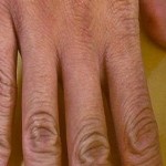 ruka-jabukovo sirće