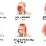 BOL-glavobolja