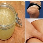 piling-za-kozu-protiv-celulita-i-strija