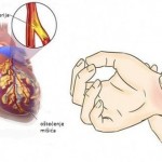 zastita-od-infarkta-1