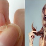 nokti-koji-se-listaju-i-suva-kosa-3