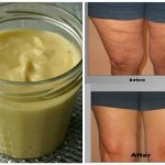 celulit-mješavina-glatka-koža-1-696x478