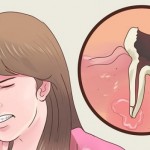 zubobolja-1466602941-934877