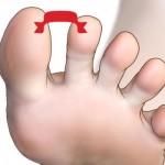 razmak-izmedju-prstiju