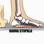 ravna-stopala