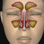 Printskrin: YouTube/Alila Medical Media