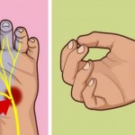 sindrom-karpalni-tunel