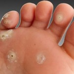 prirodni-lijek-kurije-oko