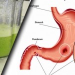 zeleni_napitak_kupus