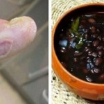 diabetes-anticki-recept