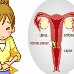 rak-grlića-maternice