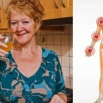 reumatoidni-artritis