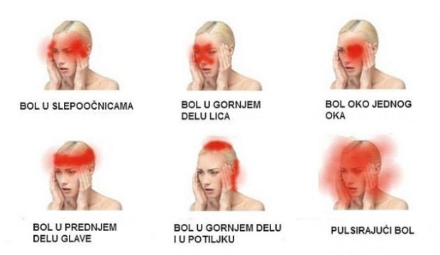 glavobolja