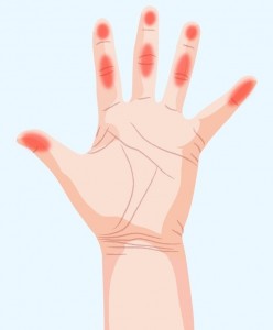 nedostatak-vitamina-1