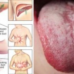 znakovi-i-simptomi-da-je-tijelo-puno-toksina