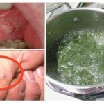 caj-imunoloska-bomba