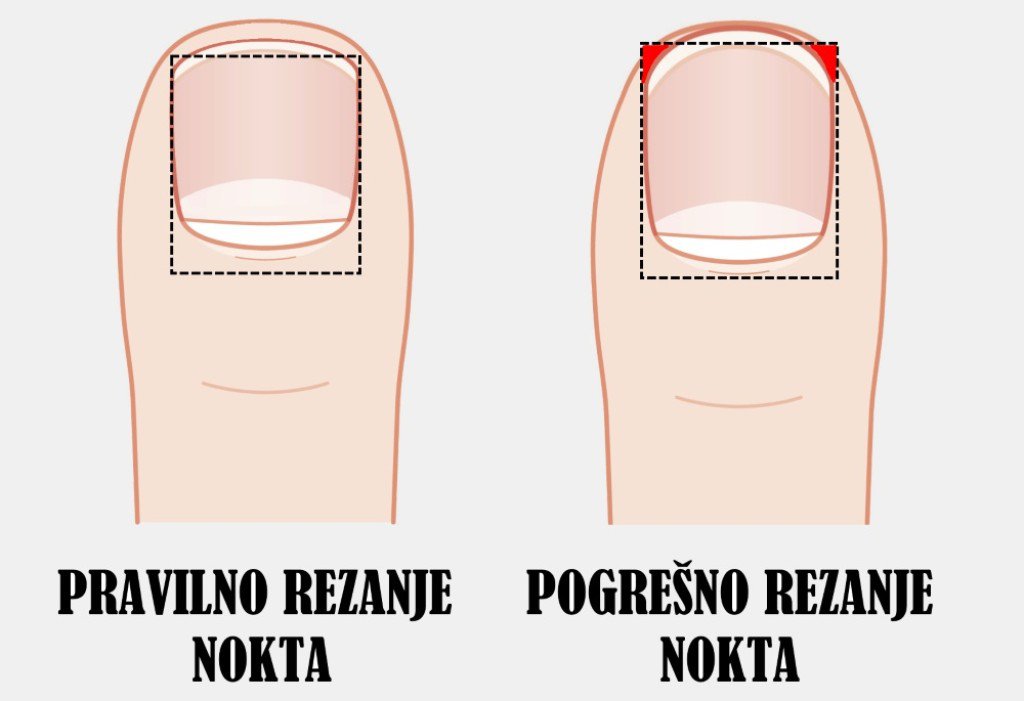 61193776-nokti-nozni-prsti