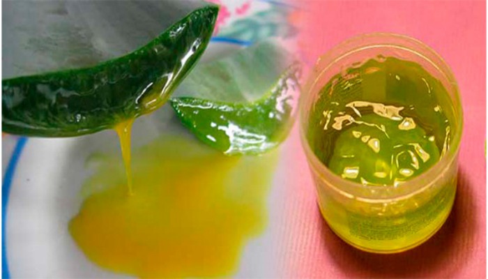 bubrezni-kamenci-gastritis