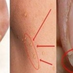 glavobolje-kosa-nokti