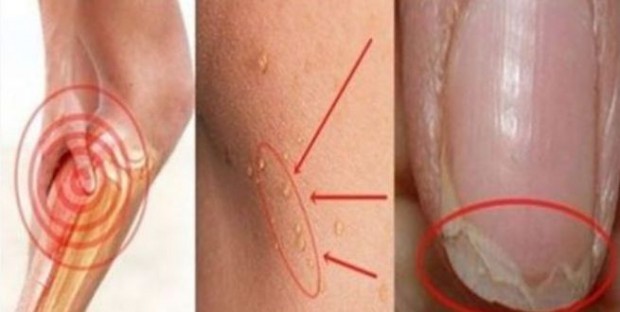 glavobolje-kosa-nokti