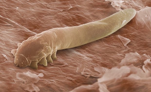 demodex-2