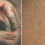 Ako-osjetite-bilo-koji-od-sljedećih-simptoma-na-vašem-tijelu-nipošto-ne-ignorišite