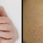 crvene-tackice-na-rukama