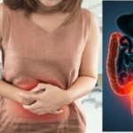 crijeva-probava-bol-stomak