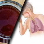 kako-izbaciti-slajm_slajm