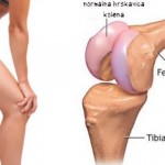 koljeno-690x480