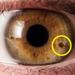 oko-mrlja