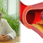 Ruski-recept-koji-razbija-tromb-Pravi-spas-za-upaljene-i-proširene-vene-647x330