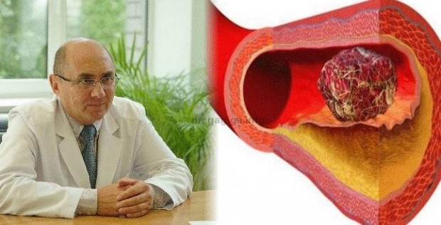 Ruski-recept-koji-razbija-tromb-Pravi-spas-za-upaljene-i-proširene-vene-647x330