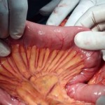 Na fotografiji dio probavnog tratka koji je obavijen novootkrivenim organom